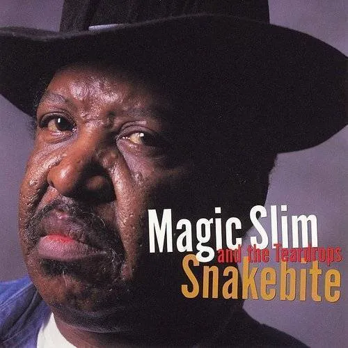Snakebite