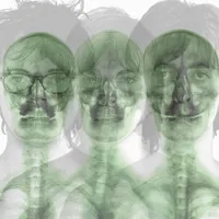 Supergrass: Remastered